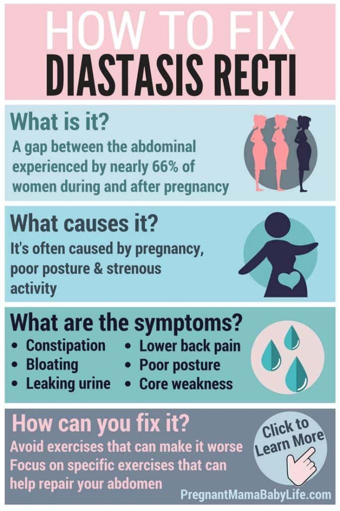 Fixing diastasis recti. How to heal your abs after birth during postpartum.