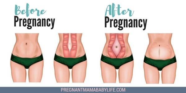 https://pregnantmamababylife.com/wp-content/uploads/2018/04/fixing-Diastasis-recti-diagram-pregnant.jpg