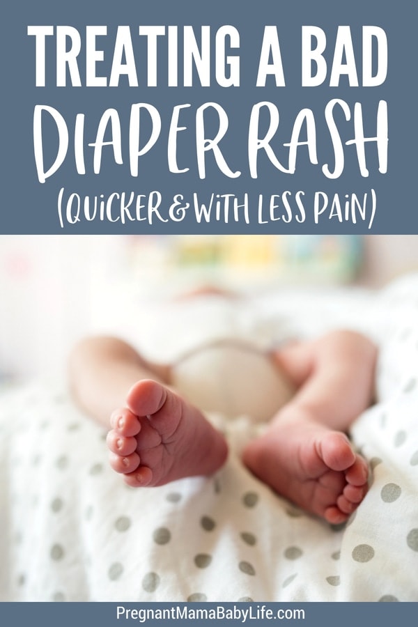 Treating a bad diaper rash quickly and naturally. 