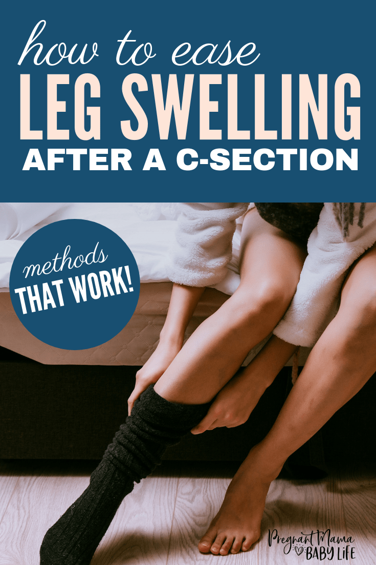 Leg swelling after a c-section