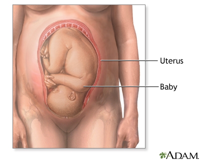 normal position of baby vs a breech position of baby