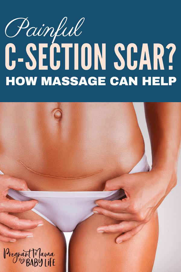 Struggling with painful scar tissue after a c-section. Even years later this can be an issue for many moms. Here's how you can help decrease the pain.