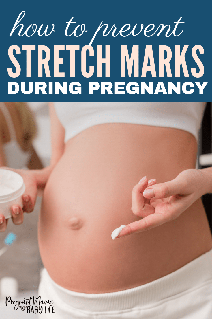 How to prevent stretch marks during pregnancy