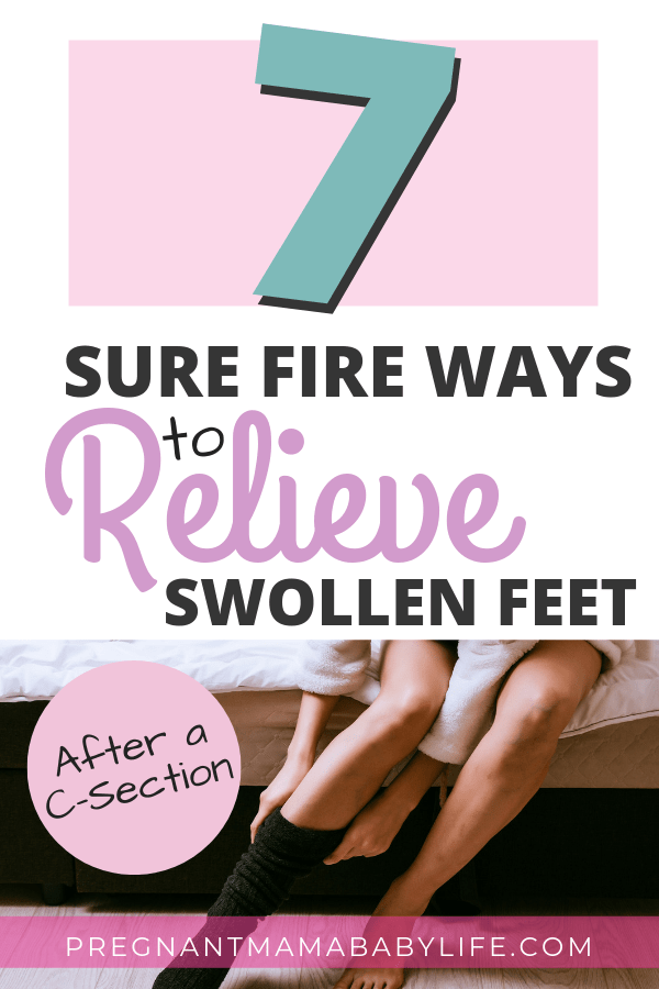 7 Ways to Stop Leg and Feet Swelling after a CSection